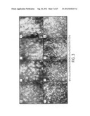 Methods and compositions for detecting and treating retinal diseases diagram and image