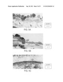 Methods and compositions for detecting and treating retinal diseases diagram and image