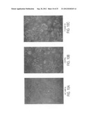 Methods and compositions for detecting and treating retinal diseases diagram and image