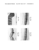 Methods and compositions for detecting and treating retinal diseases diagram and image