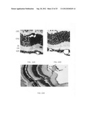 Methods and compositions for detecting and treating retinal diseases diagram and image