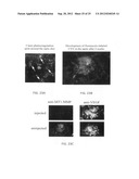 Methods and compositions for detecting and treating retinal diseases diagram and image