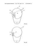  PROTECTIVE DEVICE FOR USE IN WELDING diagram and image