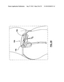 APPARATUS FOR DISTRIBUTING PRESSURE FROM A STRAP diagram and image