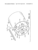 FASTENER EXTRACTION DEVICE diagram and image