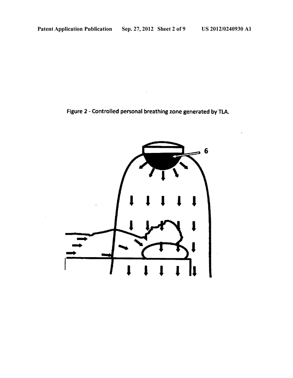 Treatment of Asthma, Allergic Rhinitis and Improvement of Quality of Sleep     by Temperature Controlled Laminar Airflow Treatment - diagram, schematic, and image 03