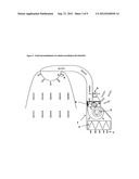 Treatment of Asthma, Allergic Rhinitis and Improvement of Quality of Sleep     by Temperature Controlled Laminar Airflow Treatment diagram and image