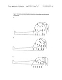 Treatment of Asthma, Allergic Rhinitis and Improvement of Quality of Sleep     by Temperature Controlled Laminar Airflow Treatment diagram and image