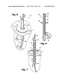 WIRE GUIDES AND ANCHORS FOR ENDOSCOPY diagram and image