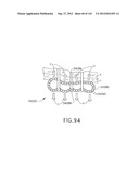 TISSUE THICKNESS COMPENSATOR COMPRISING CONTROLLED RELEASE AND EXPANSION diagram and image