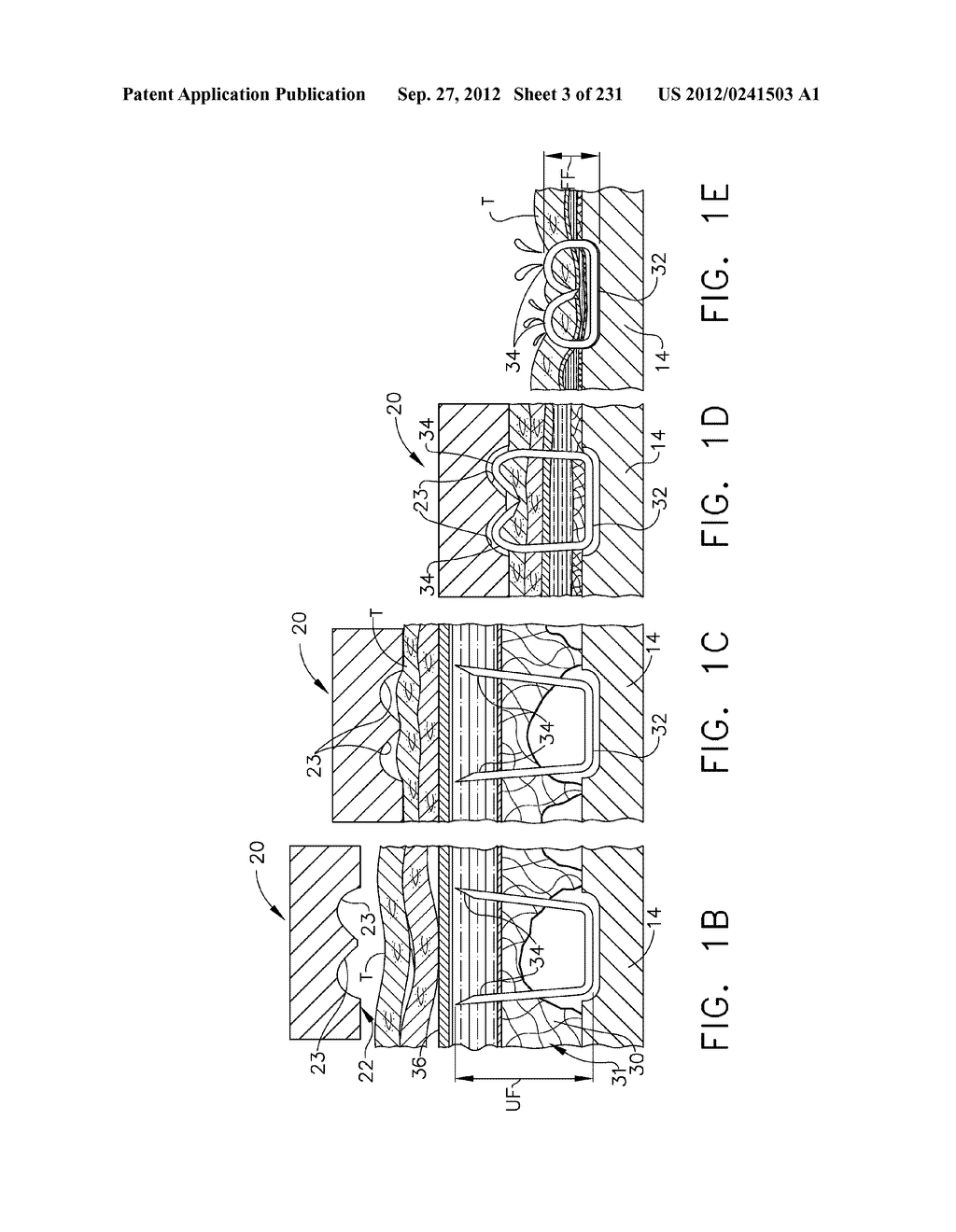 TISSUE THICKNESS COMPENSATORS - diagram, schematic, and image 04