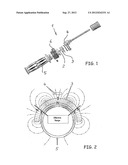 HALL-BASED ROTATIONAL ANGLE MEASURING SYSTEM, IN PARTICULAR FOR     HAND-OPERATED THROTTLES diagram and image