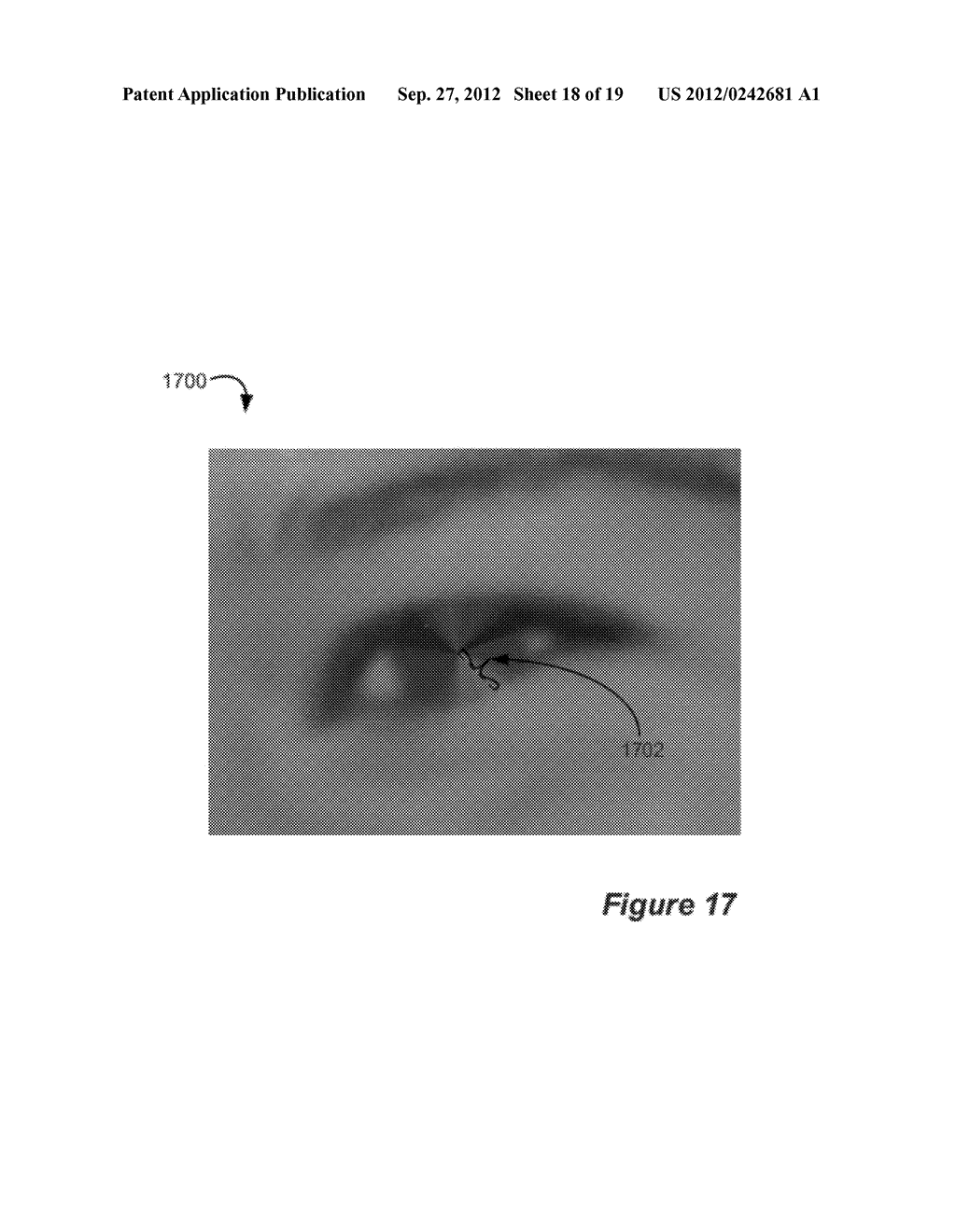 Red-Eye Removal Using Multiple Recognition Channels - diagram, schematic, and image 19