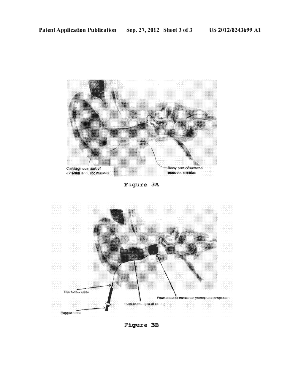 EAR CANAL TRANSDUCER MOUNTING SYSTEM - diagram, schematic, and image 04