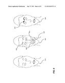 BASELINE FACE ANALYSIS diagram and image