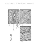 MUTANT INTERLEUKIN-2 POLYPEPTIDES diagram and image