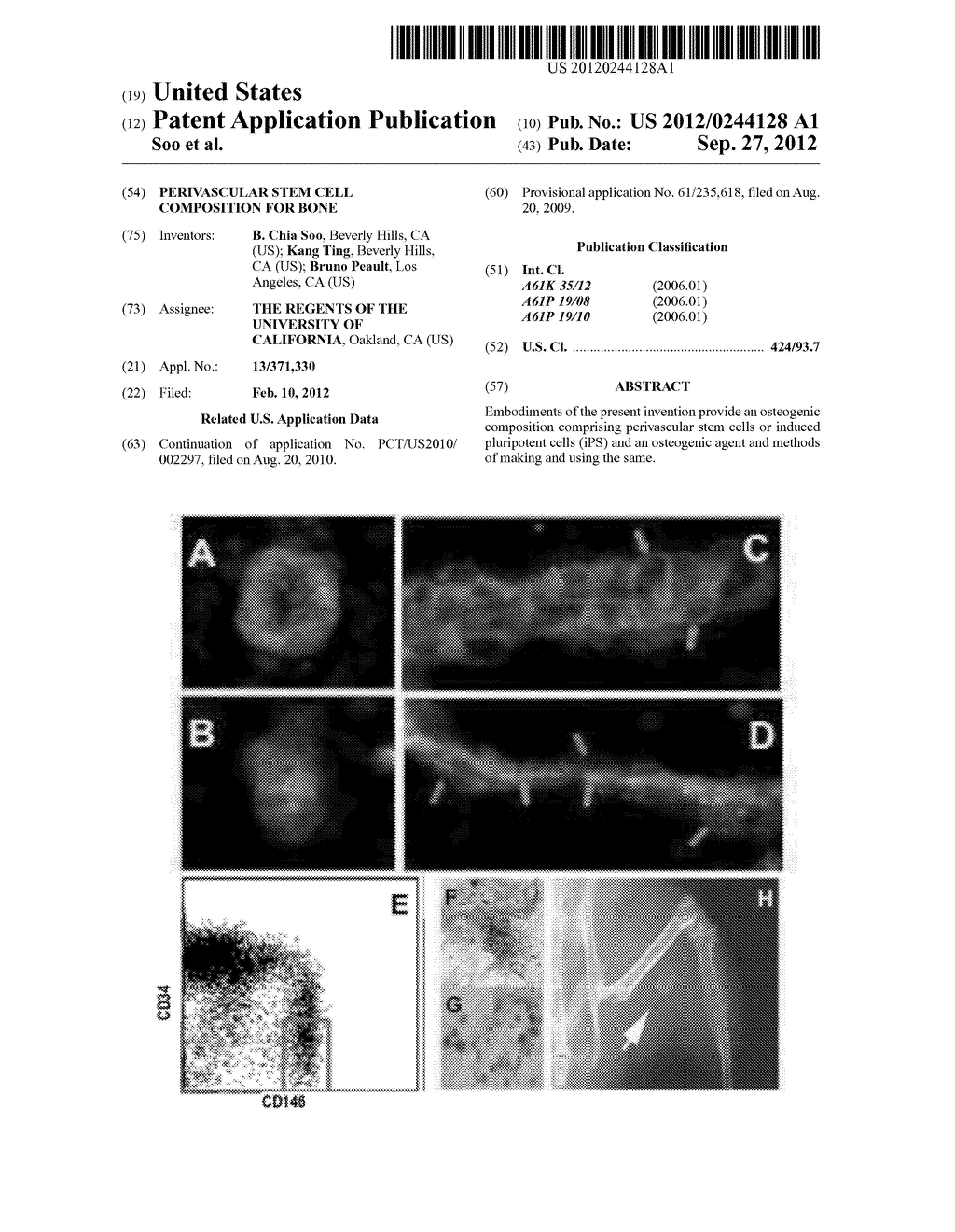 Perivascular Stem Cell Composition For Bone - diagram, schematic, and image 01