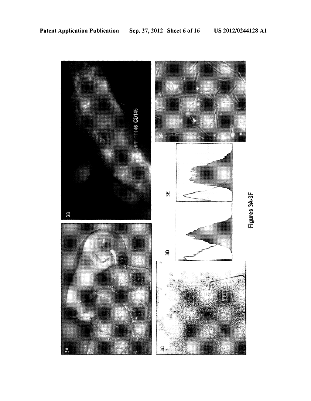 Perivascular Stem Cell Composition For Bone - diagram, schematic, and image 07