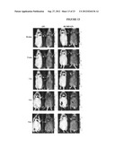 Cardiac-Specific Protein Targeting Domain diagram and image