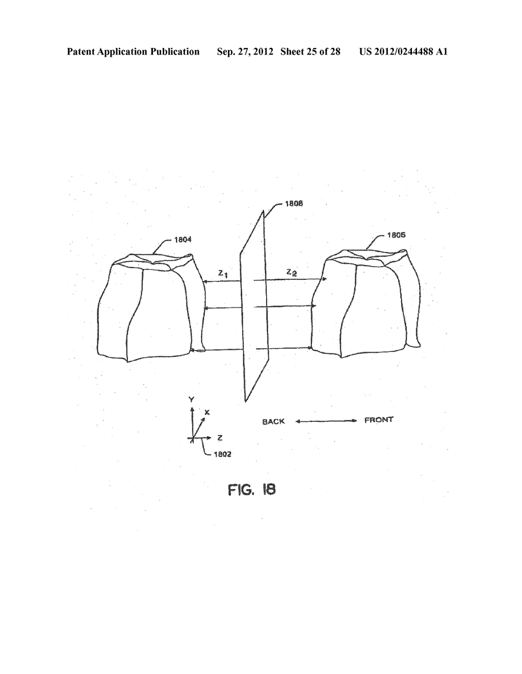 COMPUTER AUTOMATED DEVELOPMENT OF AN ORTHODONTIC TREATMENT PLAN AND     APPLIANCE - diagram, schematic, and image 26