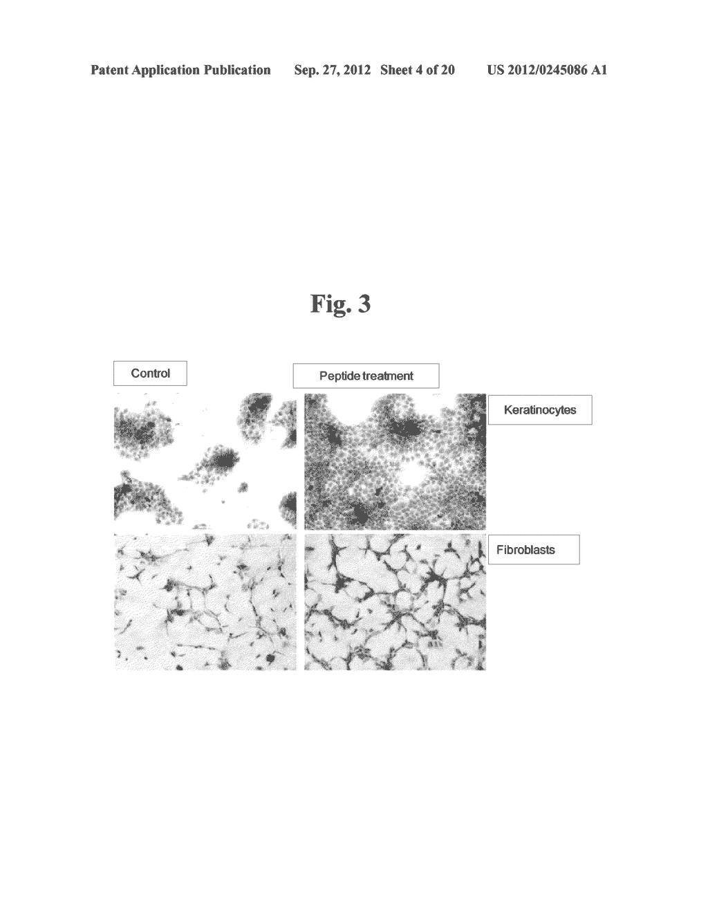 WNT10-Derived Peptide and Use Thereof - diagram, schematic, and image 05