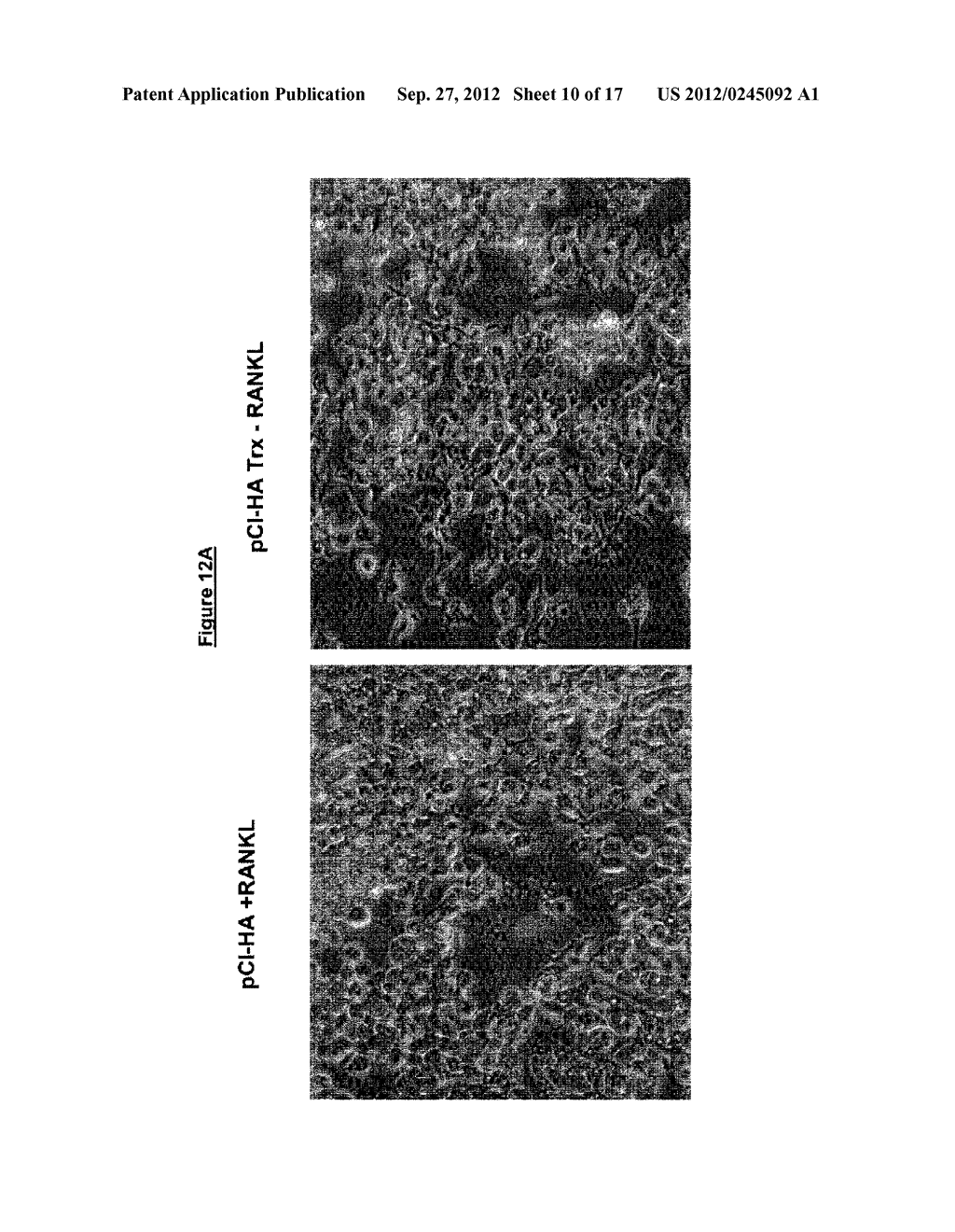 POLYPEPTIDES HAVING MODULATORY EFFECTS ON CELLS - diagram, schematic, and image 11