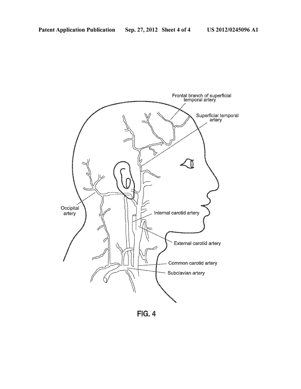 TARGETED DELIVERY OF BOTULINUM TOXIN FOR THE TREATMENT AND PREVENTION OF     TRIGEMINAL AUTONOMIC CEPHALGIAS, MIGRAINE AND VASCULAR CONDITIONS - diagram, schematic, and image 05