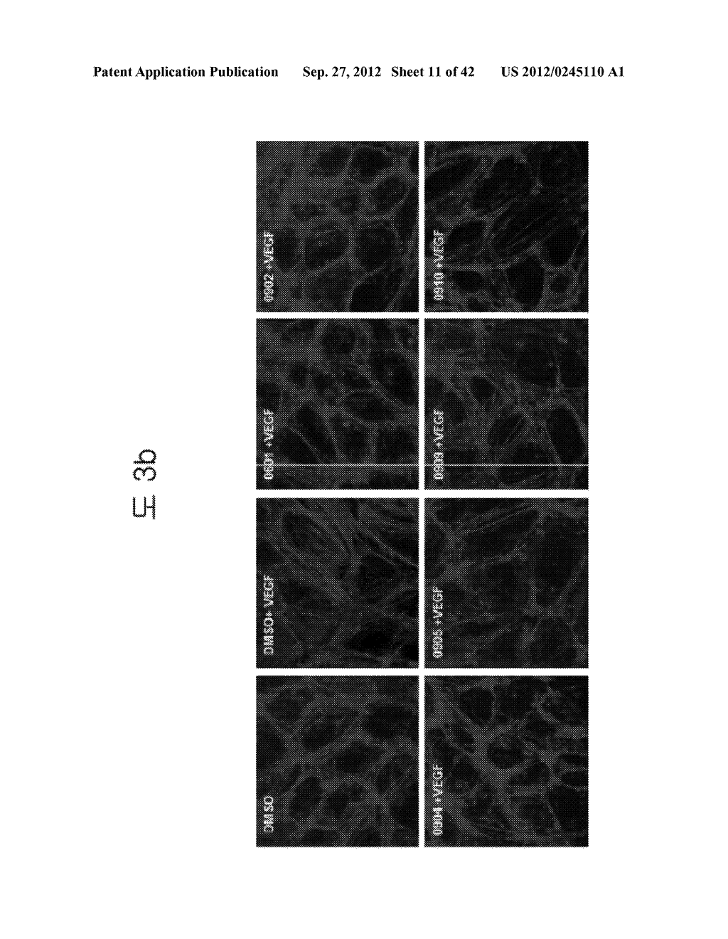 VASCULAR LEAKAGE INHIBITOR - diagram, schematic, and image 12