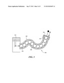 Line Transmission for Vibratory Actuation in Implantable Transducers diagram and image