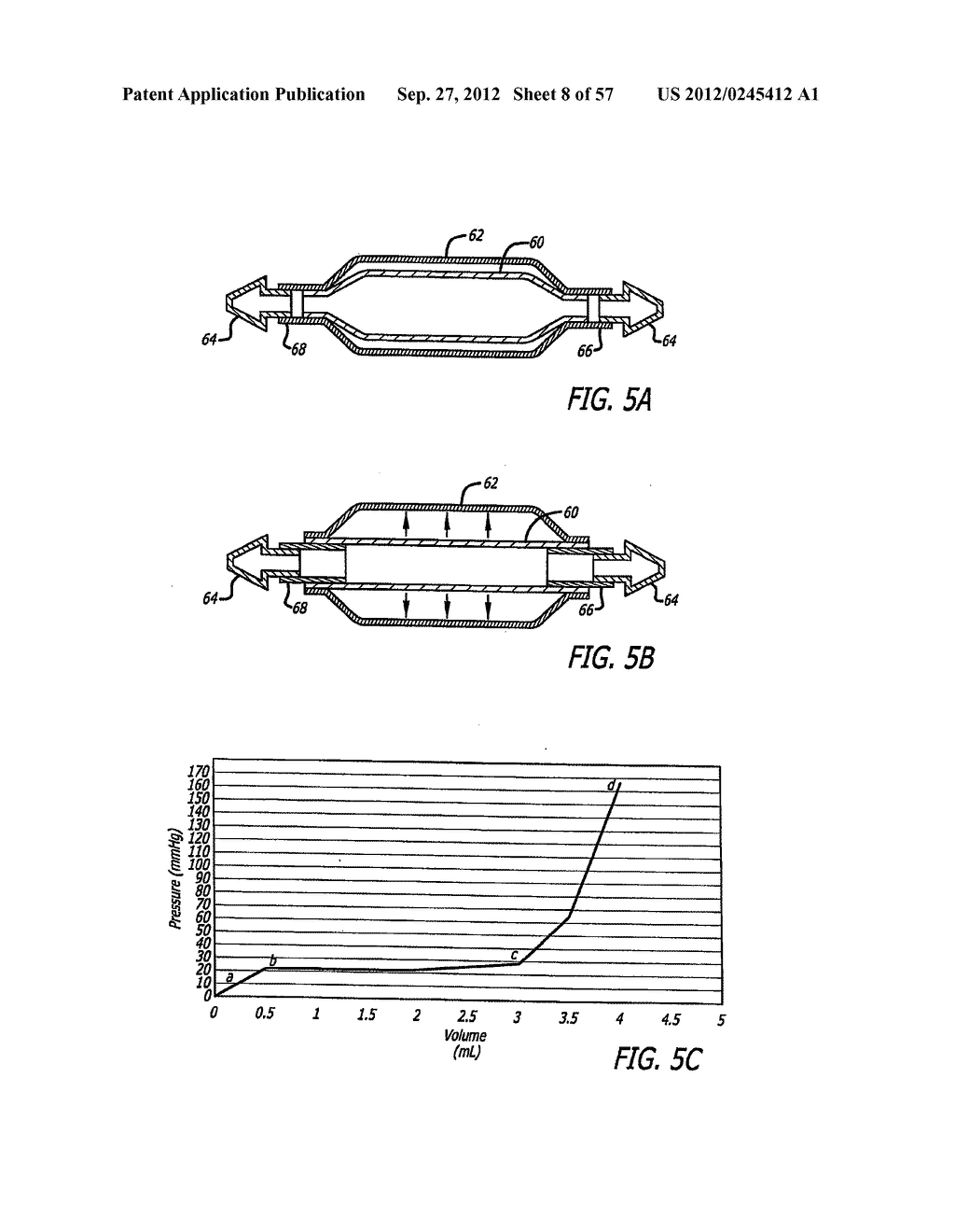 METHOD FOR MODULATING CHANGES IN INTRA-BAND PRESSURE IN A GASTRIC BAND - diagram, schematic, and image 09