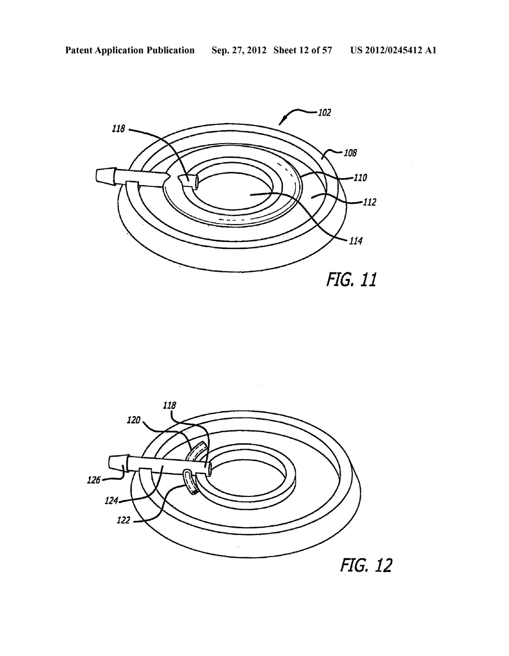 METHOD FOR MODULATING CHANGES IN INTRA-BAND PRESSURE IN A GASTRIC BAND - diagram, schematic, and image 13