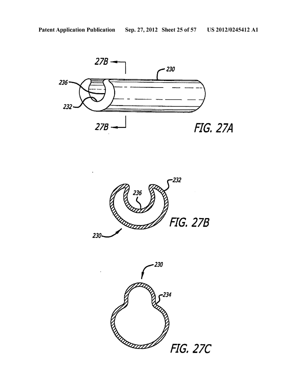 METHOD FOR MODULATING CHANGES IN INTRA-BAND PRESSURE IN A GASTRIC BAND - diagram, schematic, and image 26