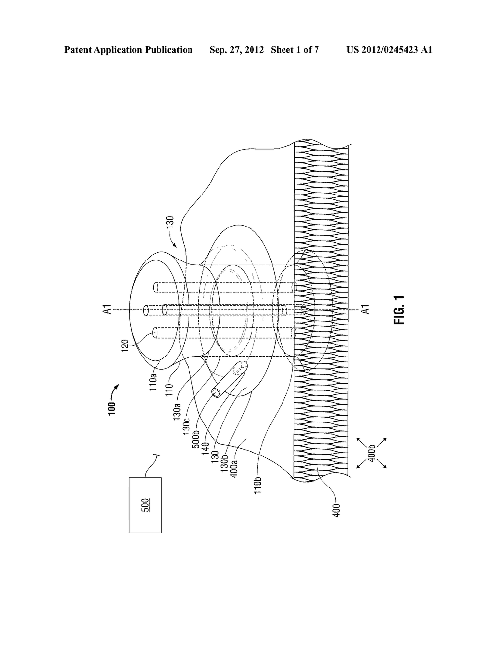 RETENTION MEMBER FOR LAPAROSCOPIC ACCESS DEVICE - diagram, schematic, and image 02