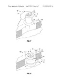 SURGICAL ACCESS PORT EXPANDABLE ADAPTER COLLAR ASSEMBLY diagram and image