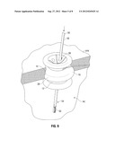 SURGICAL ACCESS PORT EXPANDABLE ADAPTER COLLAR ASSEMBLY diagram and image