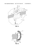 SURGICAL ACCESS PORT EXPANDABLE ADAPTER COLLAR ASSEMBLY diagram and image