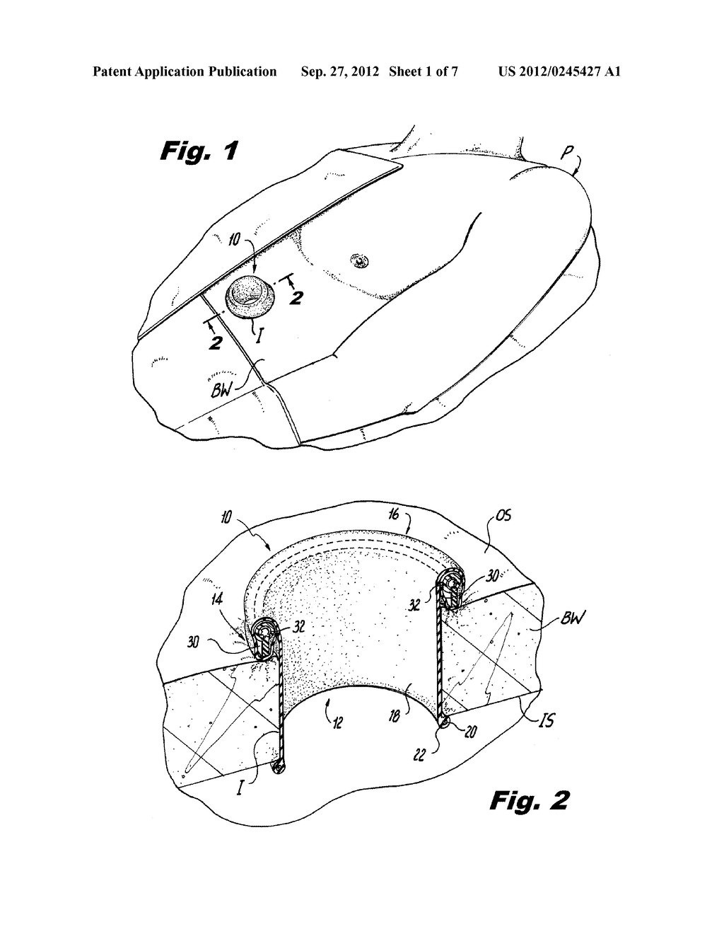 SURGICAL RETRACTOR INCLUDING ROTATABLE KNOBS - diagram, schematic, and image 02