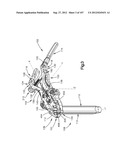 Spinal Access Retractor diagram and image