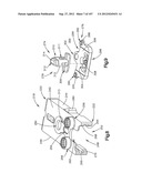 Spinal Access Retractor diagram and image