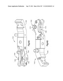 Spinal Access Retractor diagram and image