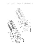 Spinal Access Retractor diagram and image