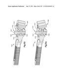 Spinal Access Retractor diagram and image