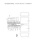 Spinal Access Retractor diagram and image