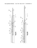 Spinal Access Retractor diagram and image