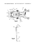 Spinal Access Retractor diagram and image