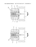 Spinal Access Retractor diagram and image