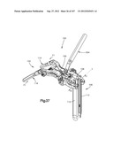 Spinal Access Retractor diagram and image