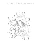 Spinal Access Retractor diagram and image