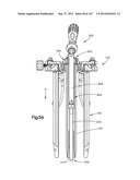 Spinal Access Retractor diagram and image