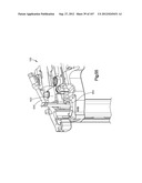 Spinal Access Retractor diagram and image